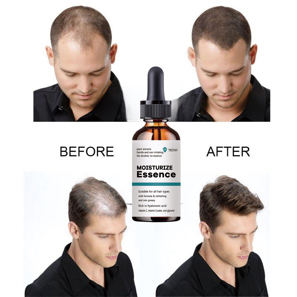 Hair Care Ordinary - 2022 neue Haar Wachstum Essenz Fördert