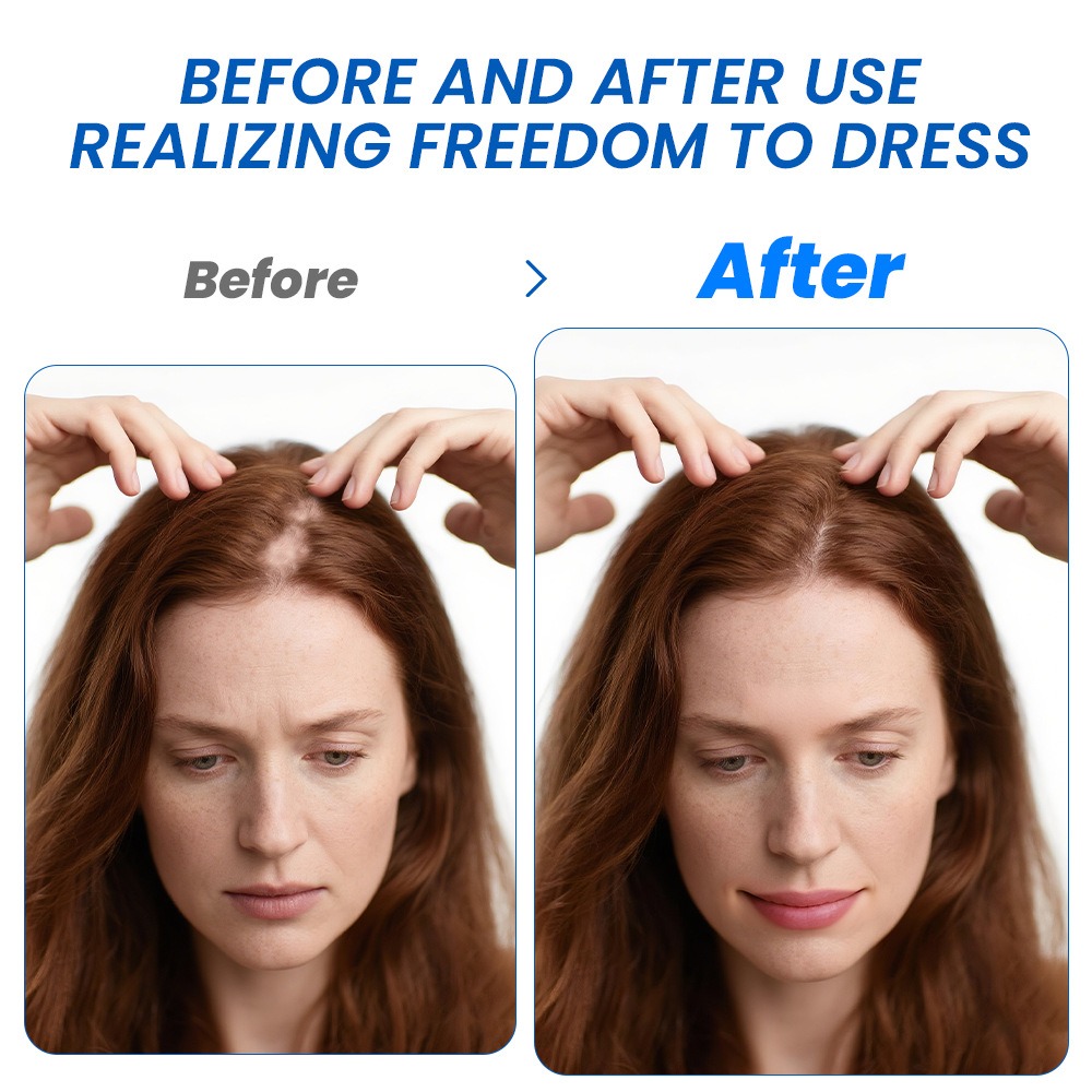Alopecia Haarwachstumsspray So – Hair Care Cream Bewertung und Preis