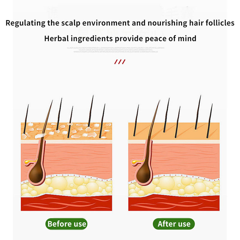 Sophora Flavescens Haarfollike – Hair Care Oil Bewertung und Preis
